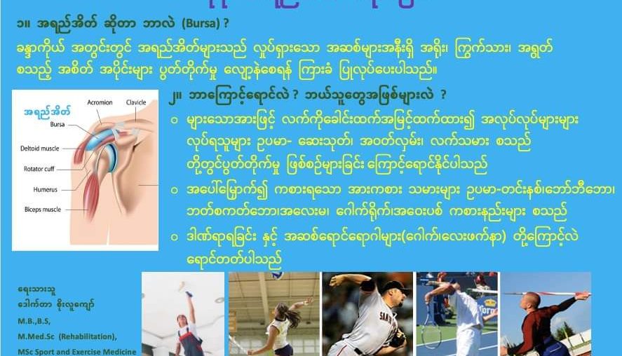 ပုခုံး အရည်အိတ် ရောင်ခြင်း » ဒေါက်တာစိုးလူကျော်